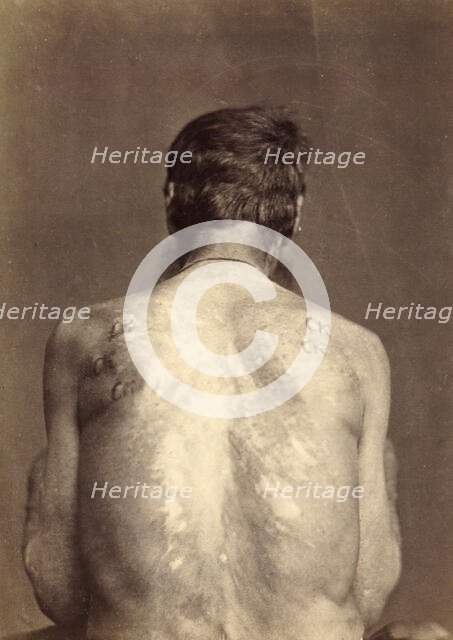 Invalid with 13 Brands, Punished Seven Times, 1891. Creator: Aleksei Kuznetsov.