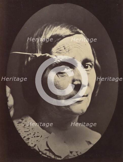 Figure 26: Expression of painful attention and attention, attentive gaze. , 1854-56, printed 1862. Creators: Duchenne de Boulogne, Adrien Alban Tournachon.