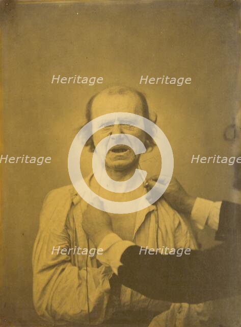 Discontent, bad humor, 1854-1856, printed 1862. Creator: Duchenne de Boulogne.