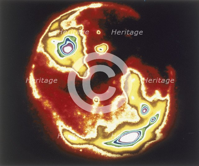 X-ray image of sun, Skylab, 1970s. Artist: Unknown