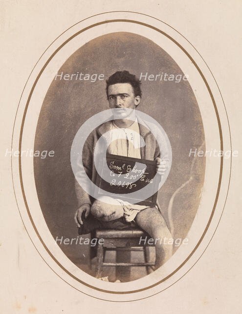 Private Samuel Shoop, Company F, 200th Pennsylvania Infantry, April-May 1865. Creator: Reed Brockway Bontecou.