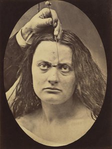 Figure 82: Lady Macbeth, strong expression of cruelty , 1854-56, printed 1862. Creators: Duchenne de Boulogne, Adrien Alban Tournachon.