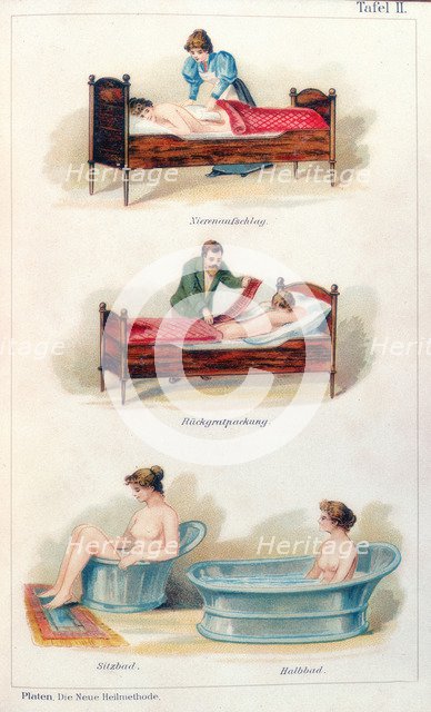 Hydrotherapy treatments, c1902. Artist: Unknown