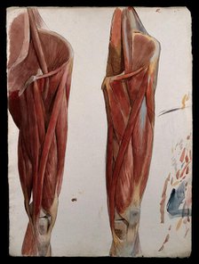 Two dissections showing the muscles of the thigh, hip, pelvis and knee, (1833?). Creator: Johann Conrad Zeller.
