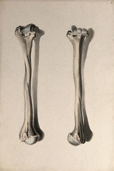 Humerus bone: two figures, 1830-1835. Creator: Unknown.
