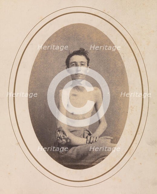 Private James H. Stokes, Company H, 185th New York Volunteers, April-May 1865. Creator: Reed Brockway Bontecou.