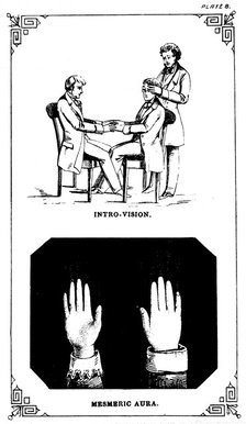 Hypnosis: introvision (power of looking into a body), 1889. Artist: Unknown