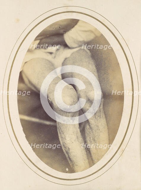 Frederick Hohmann, 1865. Creator: Reed Brockway Bontecou.