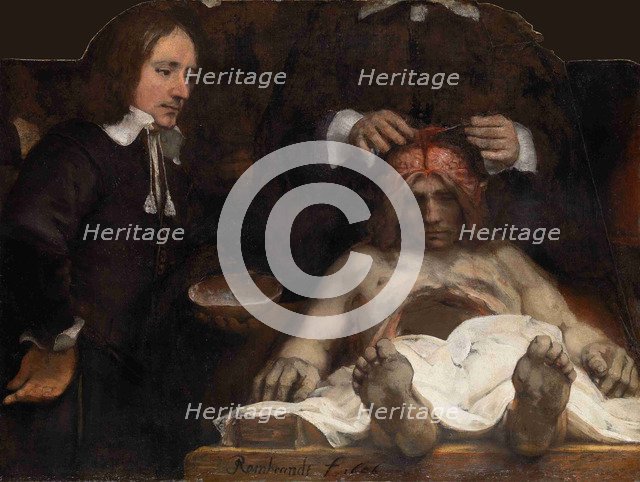 The Anatomy Lesson of Dr. Jan Deijman, 1656. Artist: Rembrandt van Rhijn (1606-1669)