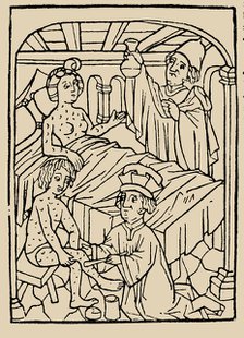 Syphilis treatment: Treatment with ointments (mercury). From: A Malafranczos morbo gallorum preserv