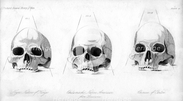 Three types of human skull, 1848. Artist: Unknown