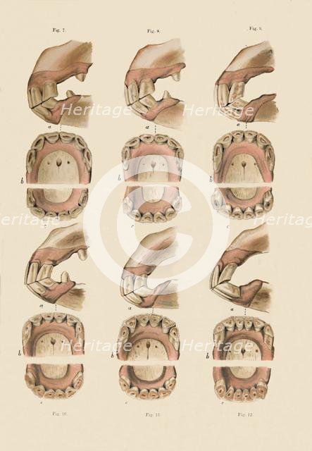 'Description of Plate Showing the Age, As Indicated By The Teeth', c1879. Creator: Unknown.