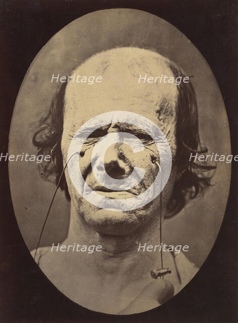 Figure 47: A suggestion of this same weeping, 1854-56, printed 1862. Creators: Duchenne de Boulogne, Adrien Alban Tournachon.