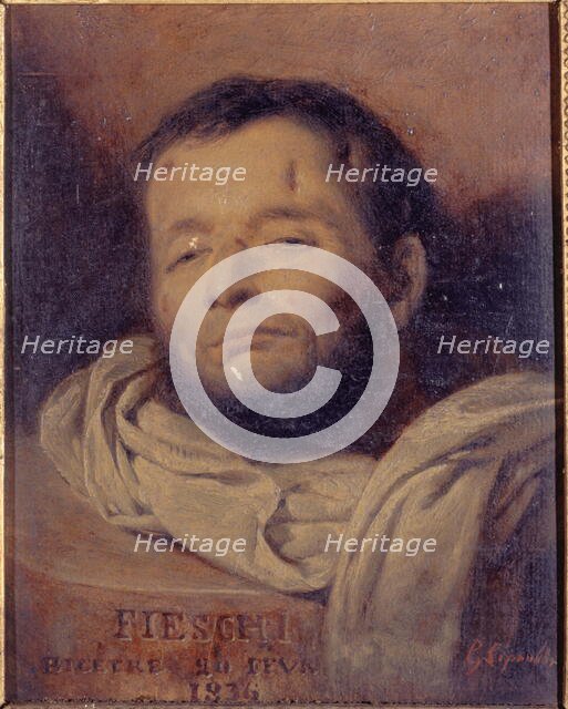 Head of Giuseppe Fieschi (1790-1836), after his execution, 1836. Creator: Francois-Gabriel-Guillaume Lepaulle.