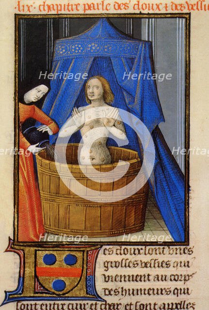 Treatment of boils with a hot herbal bath. From Livre des propriétés des choses by Barthélemy l'Angl Creator: Anonymous.