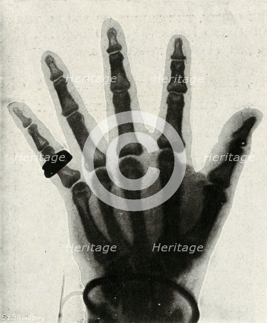 'Radiograph of the Hand of H.R.H. The Prince of Wales', (c1897). Artist: Unknown.
