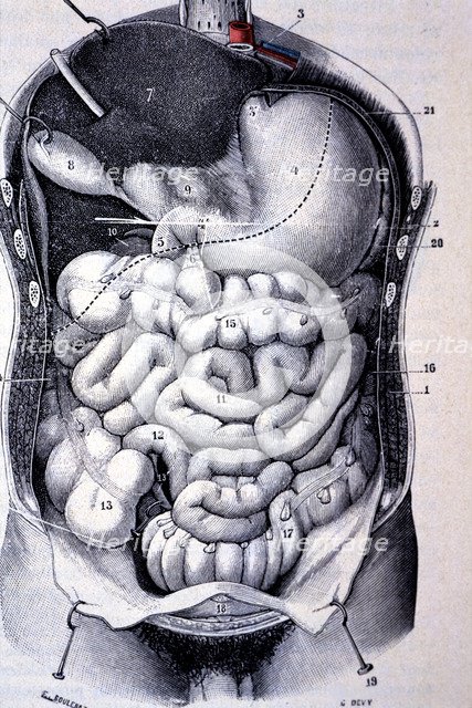 Segments of the colon seen together after resection of the anterior wall of the abdomen and thorax.