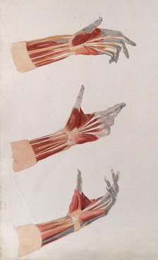 Three dissections of the left hand and wrist, showing the muscles and tendons, (1833?). Creator: Johann Conrad Zeller.