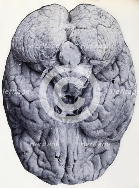 Friern Hospital, London: a brain, 1890-1910. Creator: Unknown.