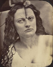 Figure 81: Lady Macbeth, moderate expression of cruelty, 1854-56, printed 1862. Creators: Duchenne de Boulogne, Adrien Alban Tournachon.