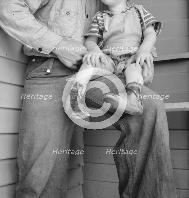 Baby with club feet wearing homemade splints, FSA camp, Tulare County, California, 1939. Creator: Dorothea Lange.