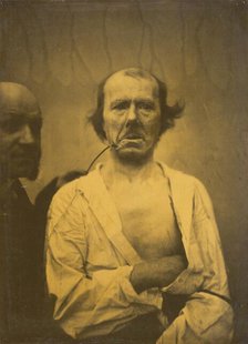 A relaxed expression (left); Disgust (right), 1854-1856, printed 1862. Creator: Duchenne de Boulogne.