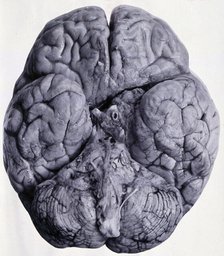 Friern Hospital, London: a brain, seen from beneath, 1890/1910. Creator: Unknown.
