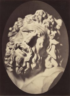 Figure 70: Head of the Laocoön of Rome, 1854-56, printed 1862. Creators: Duchenne de Boulogne, Adrien Alban Tournachon.