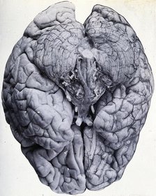 Friern Hospital, London: a brain, 1890/1910. Creator: Unknown.