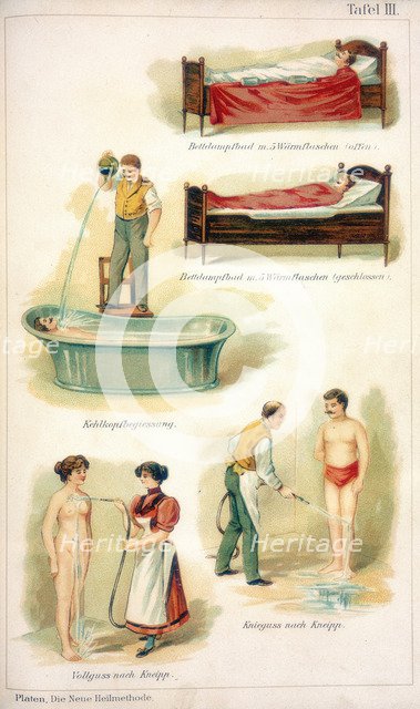 Hydrotherapy treatments, c1902. Artist: Unknown