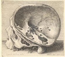Sectioned skull in profile to left with the left side of the cranium removed, 1651. Creator: Wenceslaus Hollar.