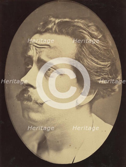 Figure 25: Not an expression of pain, 1854-56, printed 1862. Creators: Duchenne de Boulogne, Adrien Alban Tournachon.