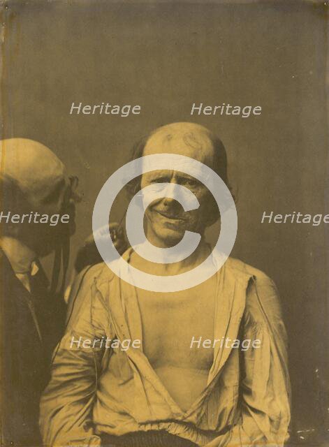 A relaxed face (left); False joy or laughter (right), 1854-1856, printed 1862. Creator: Duchenne de Boulogne.