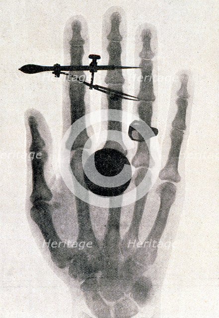 Wilhelm Roentgen's X-ray photograph of his wife's hand, 1896. Artist: Wilhelm Conrad Rontgen