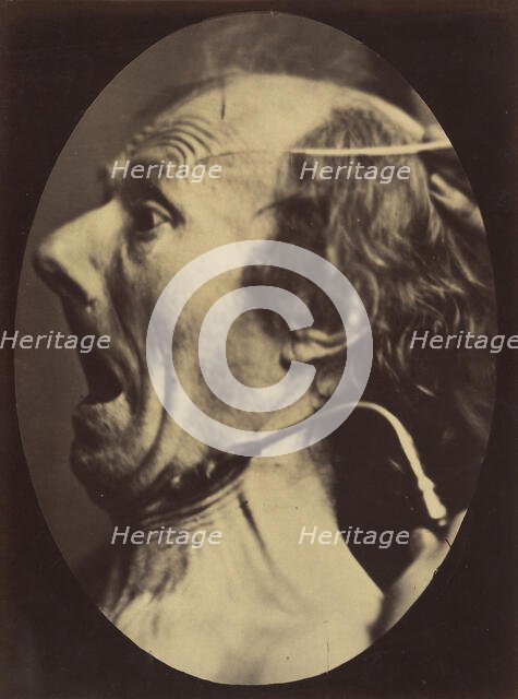 Figure 63: Expression of terror, 1854-56, printed 1862. Creators: Duchenne de Boulogne, Adrien Alban Tournachon.