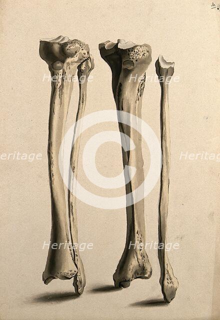 Tibia and fibula bones, 1830-1835. Creator: Unknown.