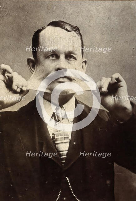 James Morris, stretching the skin on his face. Creator: Unknown.