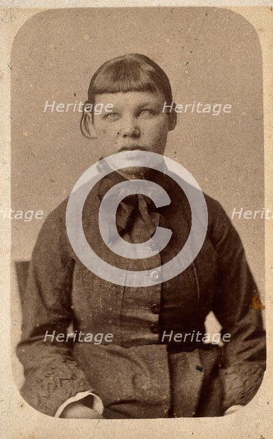 A young woman with a short fringe, showing signs of mental deficiency, c1860s. Creator: John Davis.