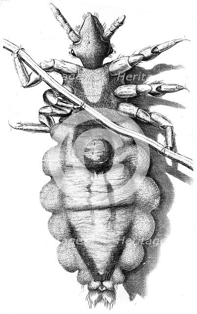 Louse clinging to a human hair, 1665. Artist: Unknown