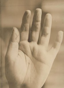 August Strindberg's hand with the inscription "Photographie aufgenommen im Hôpital Saint..., 1895. Creator: Julien Leclercq.