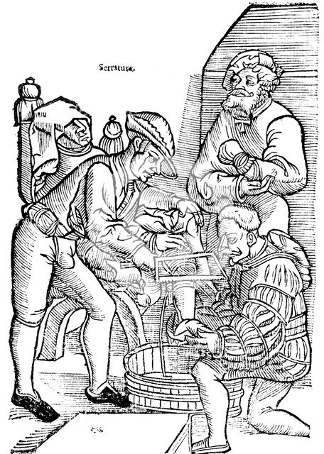 Amputation of a leg without anaesthetic, 1593. Artist: Unknown