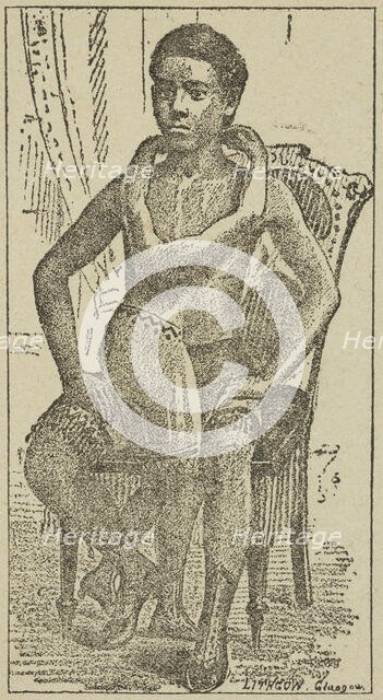 Lalloo, The Greatest Living Wonder on Earth, 1887. Creator: Unknown.