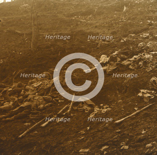 After the attack, Les Éparges, northern France, 1915.  Artist: Unknown.