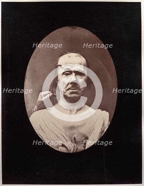 Figure 7: Étude du méchanisme et de lexpression du muscle frontal chez un vieillard: à droit..., c.  Creator: Guillaume-Benjamin-Amand Duchenne (de Boulogne) (French, 1806-1875); Adrien Tournachon (French, 1825-1903).