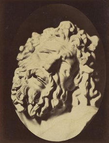Figure 71: Same head as in Plate 70, 1854-56, printed 1862. Creators: Duchenne de Boulogne, Adrien Alban Tournachon.