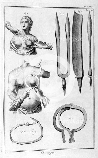 Breast surgery, 1751-1777. Artist: Unknown