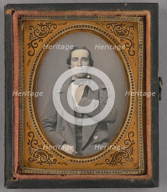 Portrait of a Seated Man with Amputated Left Arm, about 1855. Creator: Unknown.