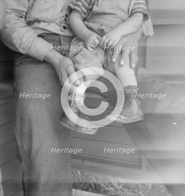 Baby with club feet wearing homemade splints, FSA camp, Tulare County, California, 1939. Creator: Dorothea Lange.