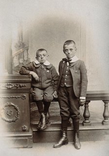 Two boys, one sitting and one standing: the former appears physically deformed, 1899. Creator: Unknown.