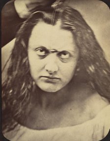 Figure 83: Lady Macbeth, ferocious cruelty, 1854-56, printed 1862. Creators: Duchenne de Boulogne, Adrien Alban Tournachon.
